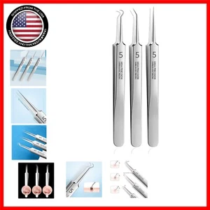 Professional Facial Blackhead Remover Tweezers,Extractor Acne Removal Kit Pimple - Picture 1 of 9
