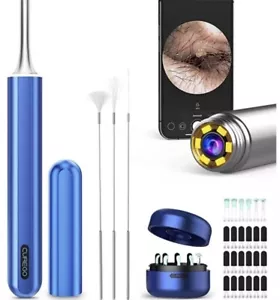 Curego X17 Pro Max Ohrwachsentfernungskamera Endoskop, ganz Aluminiumgehäuse - blau - Bild 1 von 4