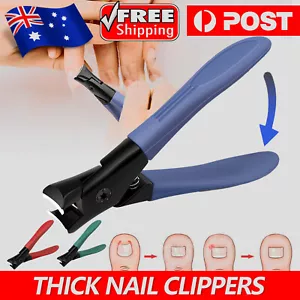 Extra Large Toe Nail Clippers Wide Jaw Opening Cutter For Thick Nails Stainless - Picture 1 of 16