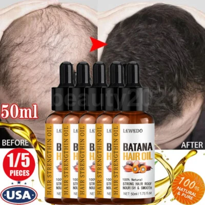 Suero de aceite de batana 3/5 piezas para el crecimiento del cabello anti-pérdida de cabello reparación de raíces de cabello dañado Foto 1 de 4