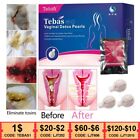 30/60/90Pcs Chinese Herbal Vaginal Detox Pearls for Women 