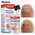 iBeaLee Nail Fungus Treatment 7DAYS Extra Strong Repair Essence Serum for Nails