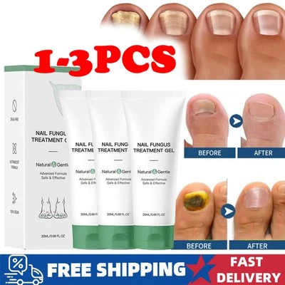 1 ~ 3Шт Nutraboost ногтей грибок лечение гель, грибок ногтей, грибок крем 2025 новый - Изображение 1 из 4
