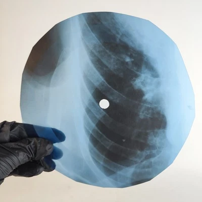 DAVID BOWIE THERE IS A HAPPY L/ X-Ray USSR Record Roentgen Bone Ribs Music Vinyl - Image 1 of 2