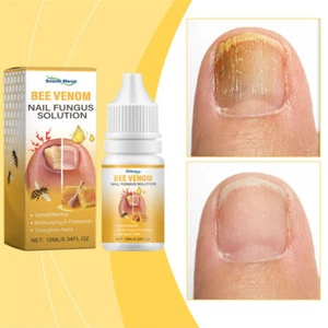 10ML Toe Fungus Nail Treatment Care Liquid Bee Venom Nail Fungus Serum- - Picture 1 of 12