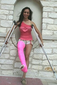 Long Leg Cast Kit | Fiberglass Orthopedic Casting Material | Broken Leg Cast - Picture 1 of 10