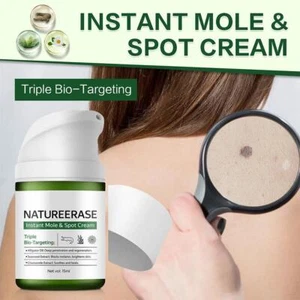 15 ml NatureErase crema istantanea talpe e macchie, rimozione talpe professionale, riparazione pelle DE - Foto 1 di 12