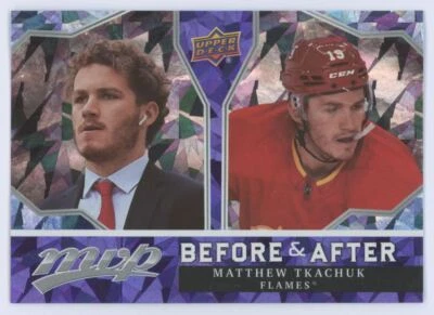 2021-22 Upper Deck MVP Before and After Matthew Tkachuk Calgary Flames #BA-16 - Image 1 of 2