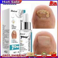 20ml Fungus Removal Gel Natural Safe Toe Nail Essence Multipurpose for Foot Care