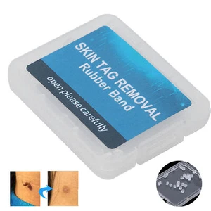 30pcs Skin Tag Removal Rubber Bands For Skin Micro Bands Accessory HR6 - Picture 1 of 22