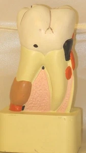 Diente caries caries caries dental modelo anatómico enseñanza escuela dentista nuevo - Imagen 1 de 2