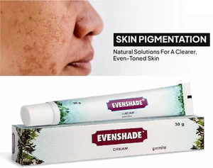 Ayurvedic Melasma Treatment Cream skin pigmentation like melasma, chloasma 30gm - Picture 1 of 3