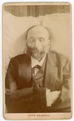 PHOTO CDV Rousseau à St Étienne, Post Mortem un homme les bras croisés barbe - Photo 1/2