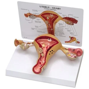 Modello anatomico GPI ovaio uterino con chiave LFA #3480. Faici un'offerta! VEDI VIDEO - Foto 1 di 2