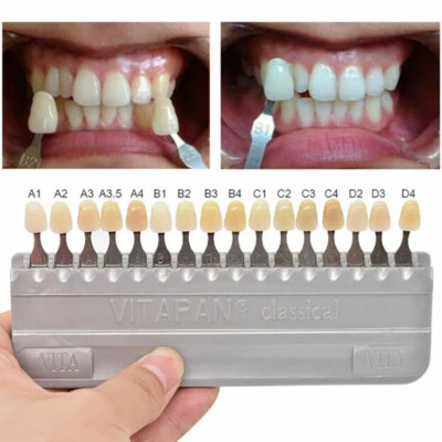 Guía de sombra dental VITAPAN 16 colores clásica PRIMERA COPIA blanquear dientes Foto 1 de 4