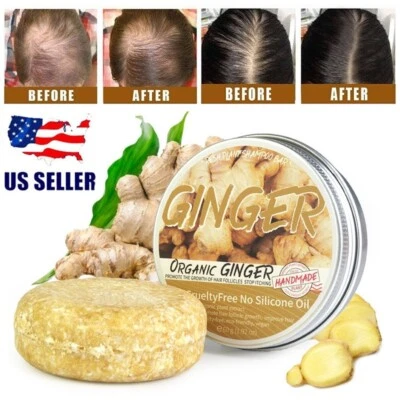 3PCS Ginger Hair Regrowth Shampoo Bar Hair Growth Soap Hair Loss Treatment USA - Image 1 of 4