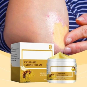 Bee Psoriasis Pflege Creme 30g N0K3 - Bild 1 von 12