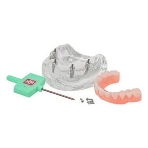 US Dental Implant Restoration Model Upper Jaw 4 Screws with Post Core Bridges - Picture 1 of 7
