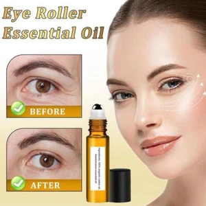 8ml Rollerball Castor Oil & Frankincense Castor Oil and Frankincense Eye Roller. - Picture 1 of 16