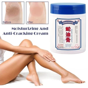 Hand and Foot Anti Cracking Moisturizing Cream Snake Ointment Q5R1 - Picture 1 of 16