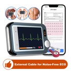 Checkme EX Bluetooth EKG Monitor 30s/60s/5min Record with AI ECG Analysis in App