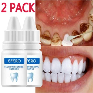 2x Gel blanqueador dental suero higiene oral dientes limpieza dental Kit de esencia - Imagen 1 de 12