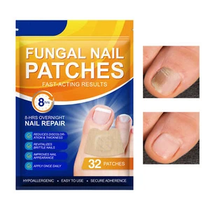 Toenail Fungus Treatment Extra Strength - 32 Patch - Overnight Nail Repair - Foto 1 di 12