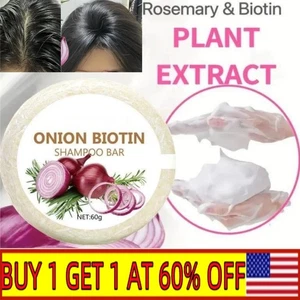 Onion and Biotin Shampoo Bar Soap, Moisturizing & Soothing, For All Hair Types~ - Picture 1 of 11