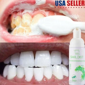 Pasta Crema Blanqueadora De Dientes Removedor De Manchas Mejor Espuma Dental NEW - Picture 1 of 7