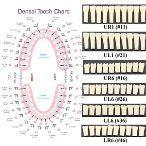 Dental Typodont Kilgore Nissin 200 Model 28 Teeth Replacement UR1 UL1 LR6 LL6 - Picture 1 of 113