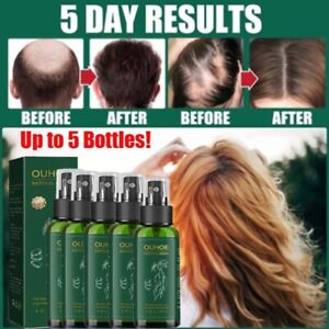 5/3Pack Ginseng Hair Growth Serum Hair Loss Treatment Liquid for Hair Regrowth