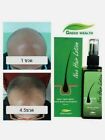 2024 Neo Hair Lotion 120ml. Hair loss treatment 100% Natural