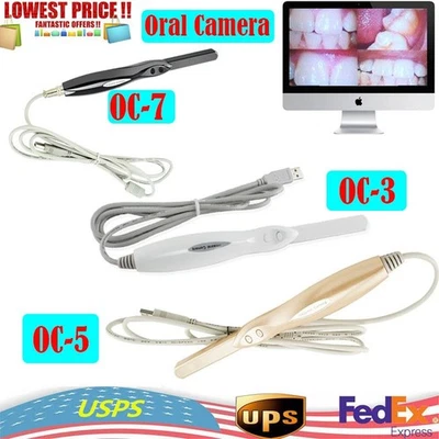 Cámara Intraoral Dental 6MP USB 2.0 LED para Dentistas Pacientes Salud Bucal Foto 1 de 4
