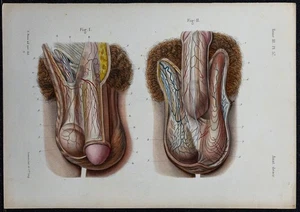 1866 - Male Genitals - Anatomy & Urology - Antique Engraving - Picture 1 of 5