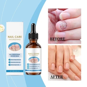 Nail Repair Serum Nail Strengthener Restore Serum Repair Damage StrongerNail New - Bild 1 von 14