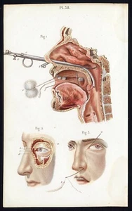 Cabinet de curiosité planche affiche A3 anatomie humaine chirurgie n°10 nez oeil - Picture 1 of 1