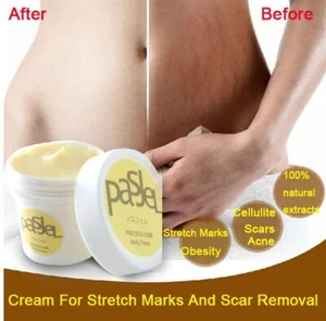 Cream For Stretch Marks And Scar Removal Powerful To Maternity Skin Body Repair - Picture 1 of 4