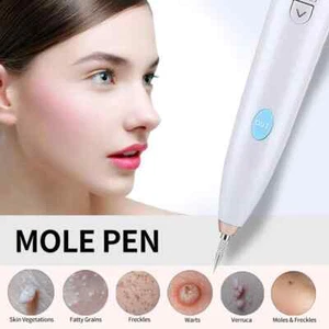 Mini Beauty mole Removal Sweep Magic Spot Pen White Anti-Aging Laser Plasma Pen - Picture 1 of 13