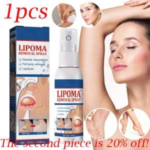 50ML Lipomheilung Reduction Spray, Instant LumpFree Lipoma Removal Spray USA Hot - Picture 1 of 14