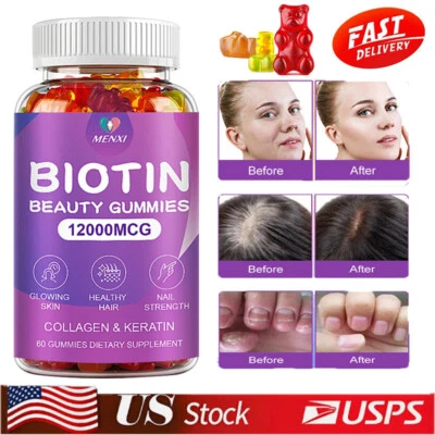 3 Pack Vitamatic Biotin Gummies 12000 mcg for Stronger Hair Skin Nails 60 Vegan - Image 1 of 4