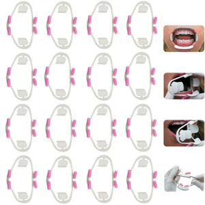 Abridor bucal dental oral 3D intraoral mejillas labios retractor utilería ortodoncia 1 pieza - Imagen 1 de 5