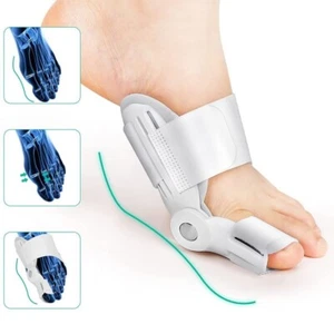 Bunion Corrector for Women Men Splint Big Toe Straightener Hallux Valgus Foot - Picture 1 of 4