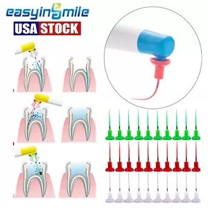 60 Stck. Easyinsmile Endo Aktivatorspitze Ultra Sonic Bewässerung für Wurzelkanal - Bild 1 von 12