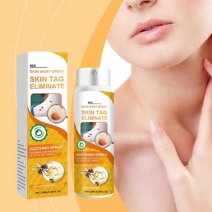20ml Wart and Tags Removal Treatment Spray 2023` T0K7 D3H1 D4V9 I3T8 Q3C1 - Picture 1 of 16