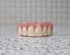 Teilweise,Zahnprothese,zahnersatz,prothese, oberkiefer, dental,Gebiss,