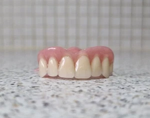 Teilweise,Zahnprothese,zahnersatz,prothese, oberkiefer, dental,Gebiss, - Bild 1 von 5