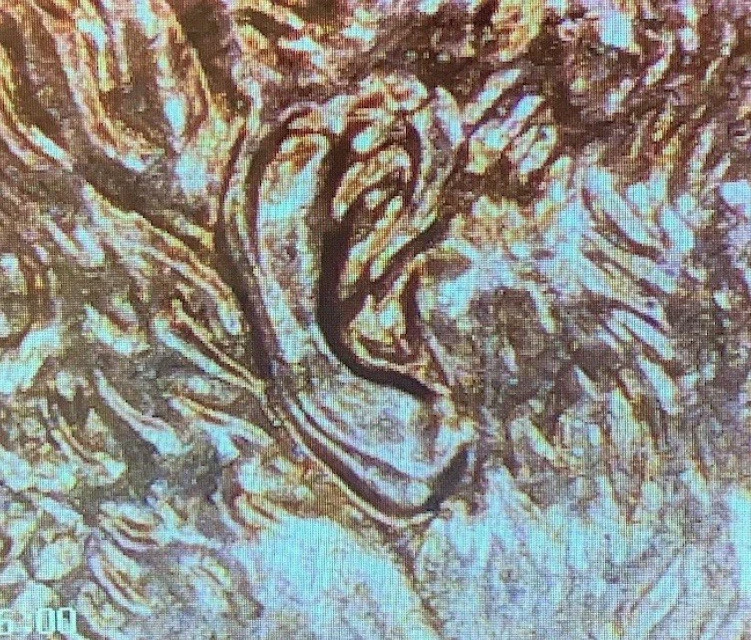 2008 P Double Ear/Nose Lincoln Memorial Cent Penny  MS A-315 - Image 1 of 4