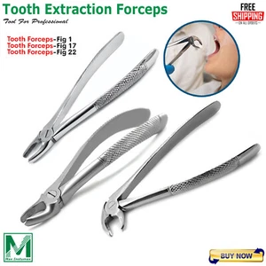 Neu Zahnextraktionspange Oralchirurgie Zahnextraktionen zahnärztliche Instrumente - Bild 1 von 5