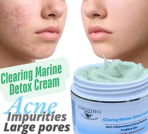 Clearing Marine Detox Cream: Natural Acne Solution with Chlorella, Seaweed, Kelp - Picture 1 of 6