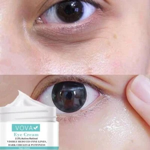 Instant Remove Eye Bags Cream Retinol Cream Dark Circles Nice Brighten X2Q3 - Picture 1 of 11